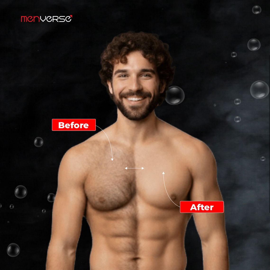 Menverse  Hair Removal Spray